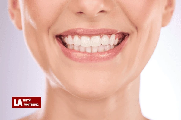 Can Laser Whitening Be Combined with Home Maintenance for Extra Brightness Hastings